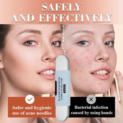 Medical grade blackhead cell clip tool set - Sale 50% Off
