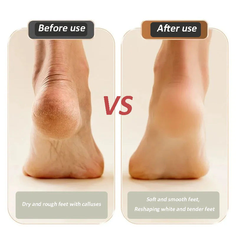 🔥Bestseller USB Rechargeable Electric Foot Repair Grinder