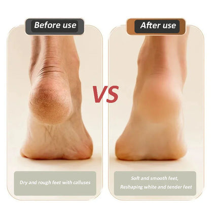 🔥Bestseller USB Rechargeable Electric Foot Repair Grinder