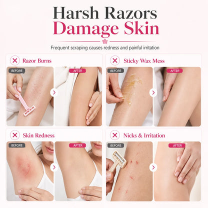 Gentle Smooth Roll-On Body Hair Removal