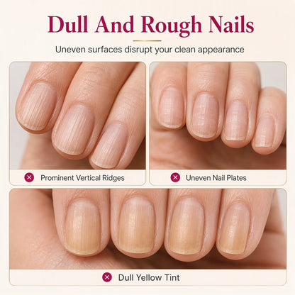 🎉Buy 1 Get 1 Free - Instantly Smooths Away Nail Ridges! Natural Nail-Smoothing Treatment