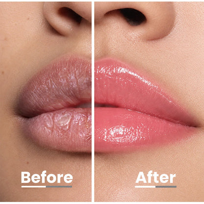 🎉LAST DAY SALE 50% OFF🎁Skincare-Grade LIP CARE with 5 PEPTIDES