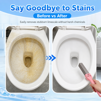 ✨Remove Stubborn Toilet Rings & Hard Water Stains in Minutes – 5 Pack Pumice Stone Cleaner with Extra Long Handle✨