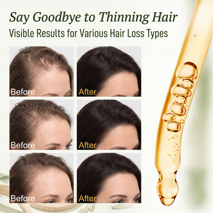 🔥🎁Buy 1 get 1 free🔥Advanced Hair Growth and Scalp Care Serum