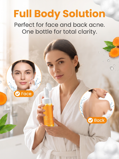 ✨Fade Acne Marks! Turmeric Soap Mousse Deep Cleansing Face Wash
