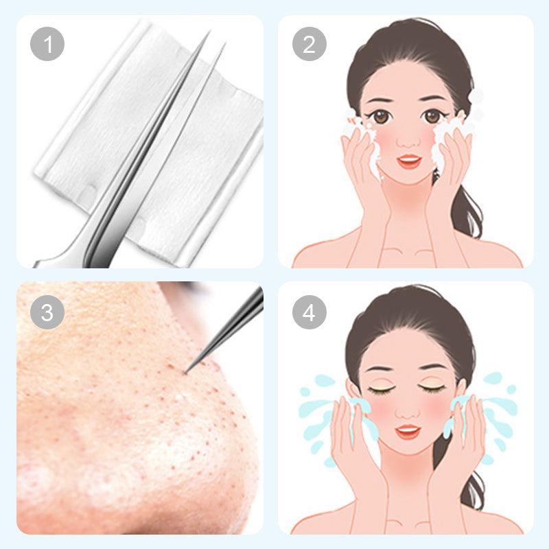 Medical grade blackhead cell clip tool set - Sale 50% Off