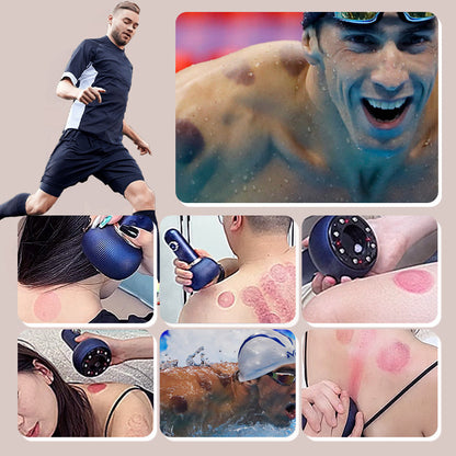 Rechargeable Smart Electric Cupping Massager Infrared Heating Vacuum Suction Deep Tissue Massage